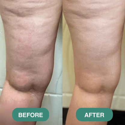 Liorla CelluBlast